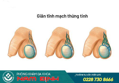 bệnh tinh hoàn