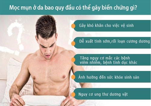 mụn bao quy đầu
