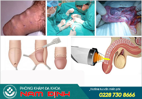 thẩm mỹ vùng kín